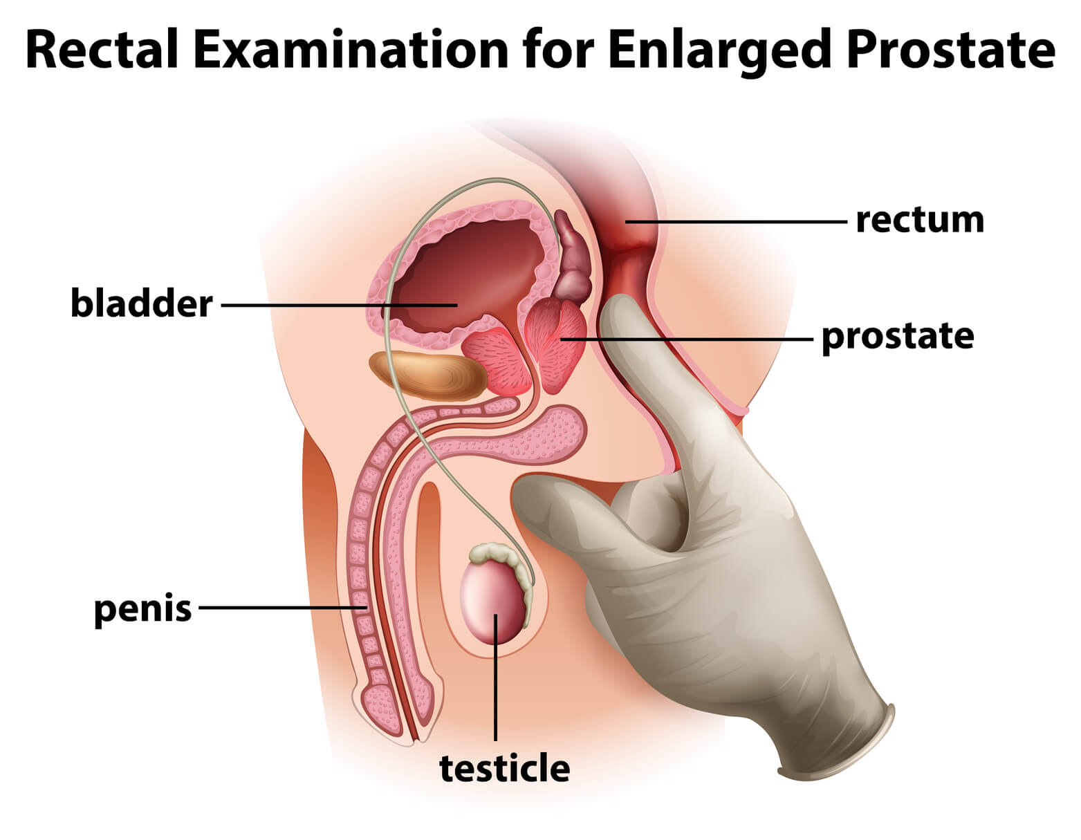 Where is the prostate gland located in the Body